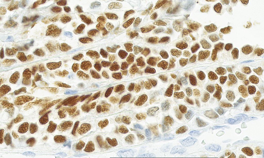 Clinical image digital pathology