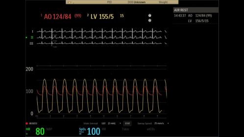 User interface - TAVI exam room