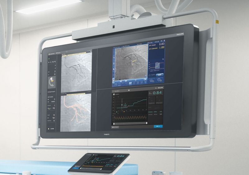 SyncVision — Precision Guidance System for Co-Registration