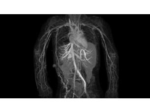 Arteriovenous TRANCE MR Clinical applications