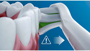 Chroni zęby i dziąsła przed nadmiernym naciskiem podczas szczotkowania