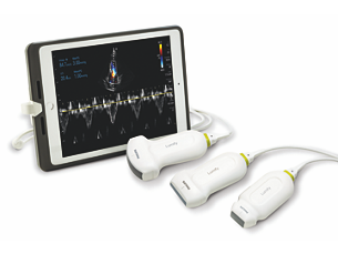 Lumify Exceptional portable ultrasound system for iOS