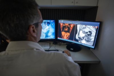 Especialista médico analizando imágenes de TC y RM en las pantallas del sistema PACS