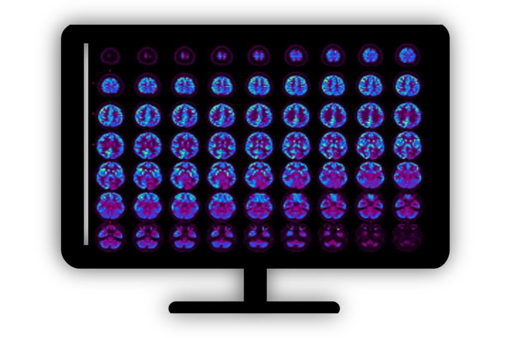 Standard product photograph