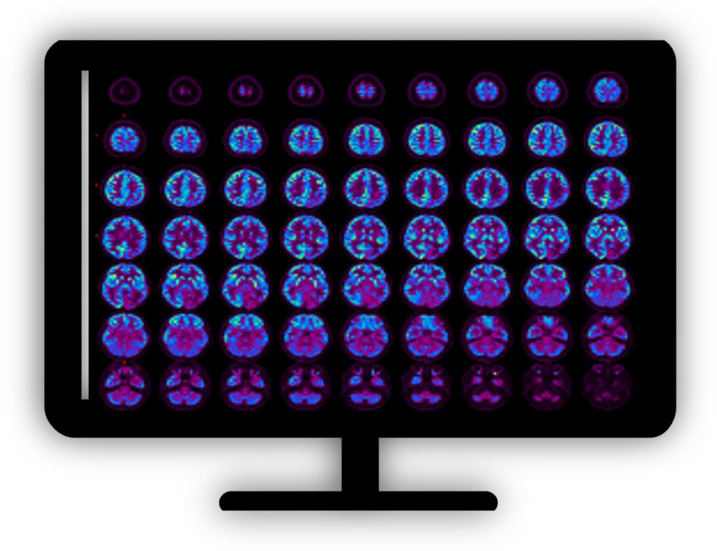 Standard product photograph