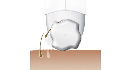 نظام إزالة الشعر الفريد من Philips