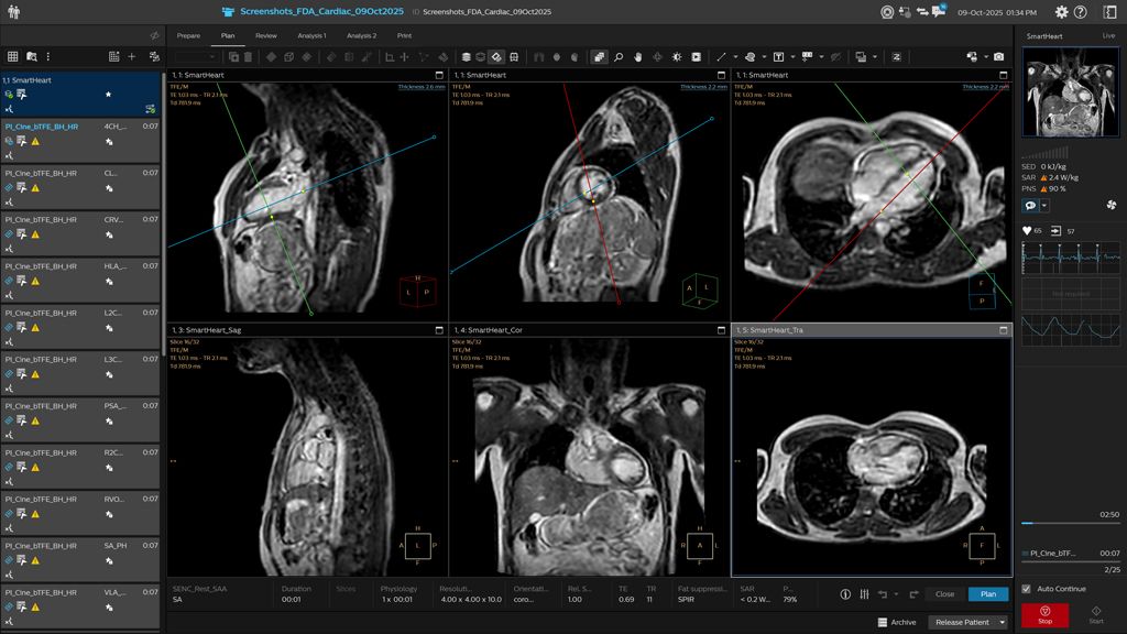One 3D survey scan for a fully automated CMR planning