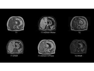 4D MR-RT MR Clinical Applications