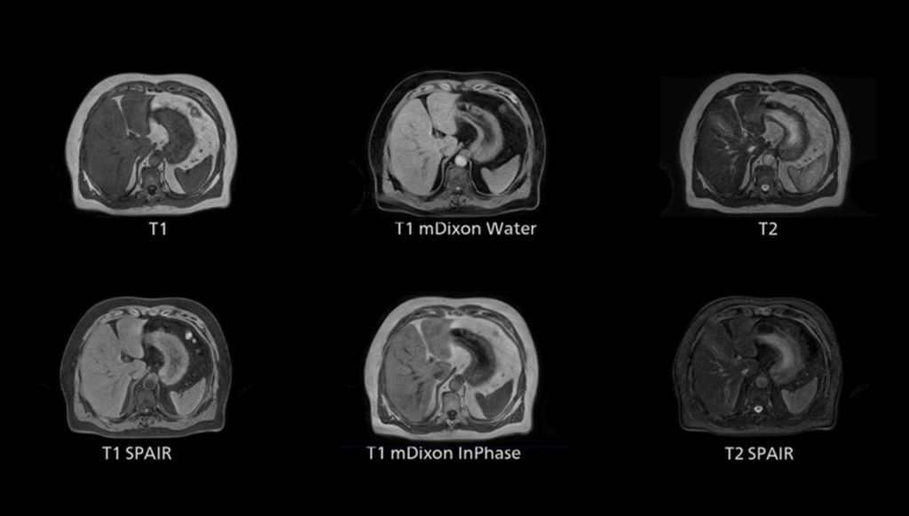 Philips - 4D MR-RT NMRF865 MR Clinical Applications - Philips