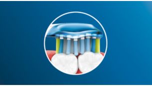 Jusqu'à 100 % de taches en moins pour des dents plus blanches