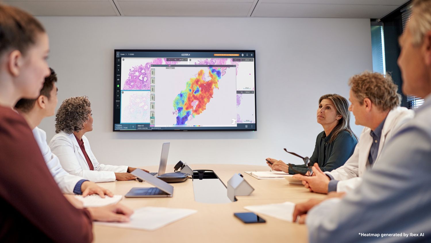 Digital Pathology collaboration board room with Ibex AI Galen Platform launched