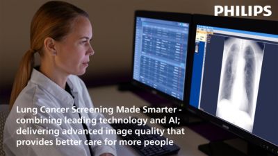 Radiologist reviewing chest x ray images on diagnostic workstation for lung cancer screening