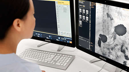 Технология обработки изображений Dynamic UNIQUE — высокое качество рентгеноскопических исследований, отображение даже скрытых деталей