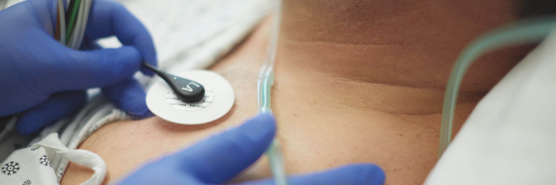 electrodes and ecg leads