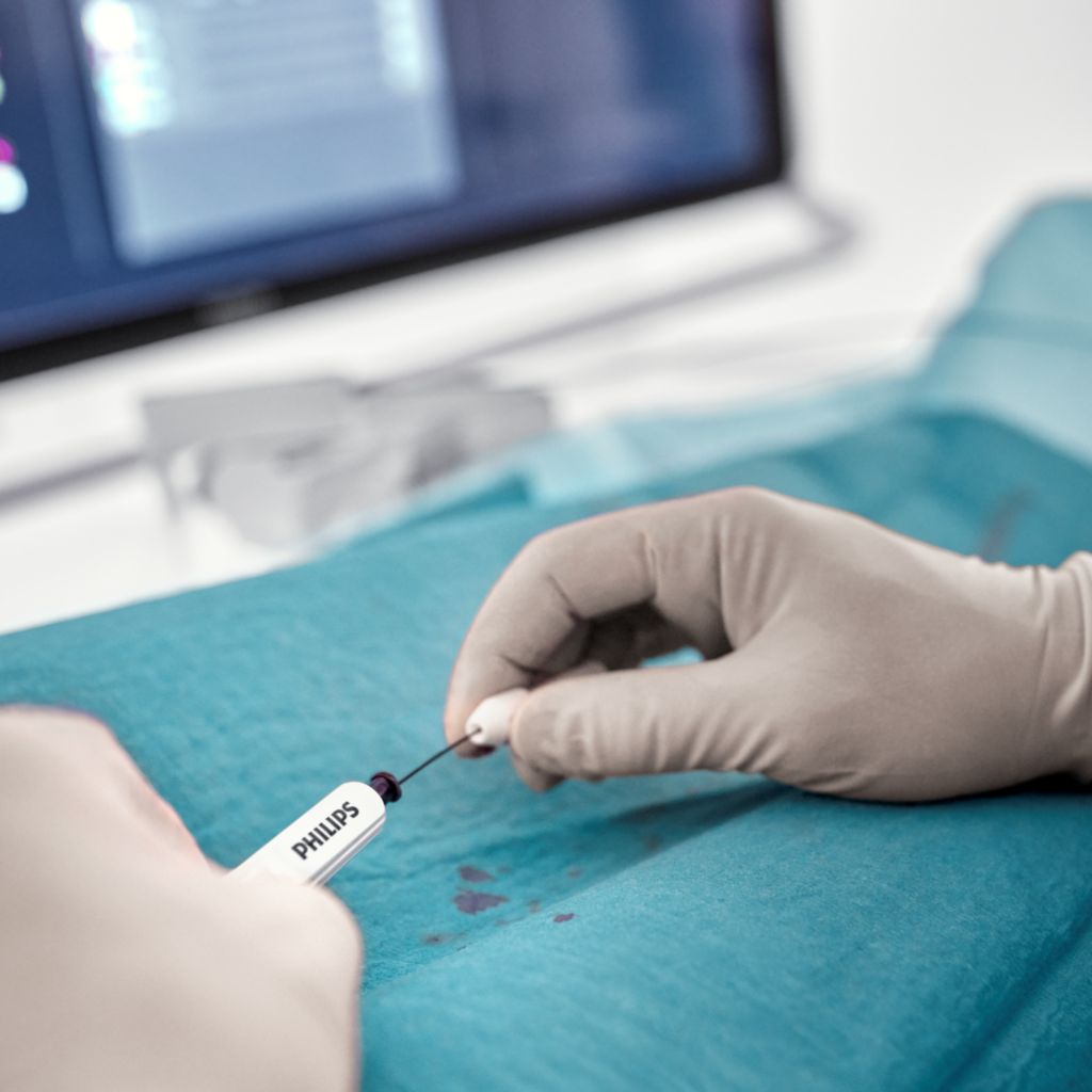 Visualize the catheter