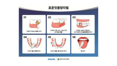 표준잇몸양치법
