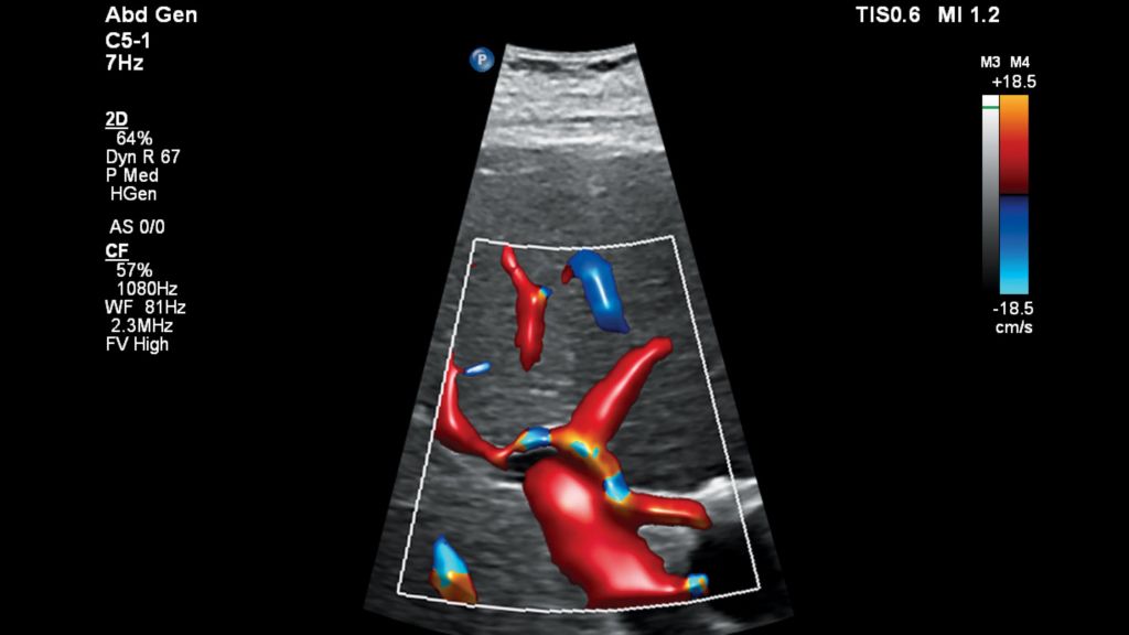 Liver Flow Viewer
