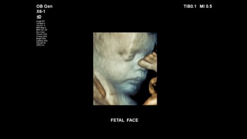 Fetal face