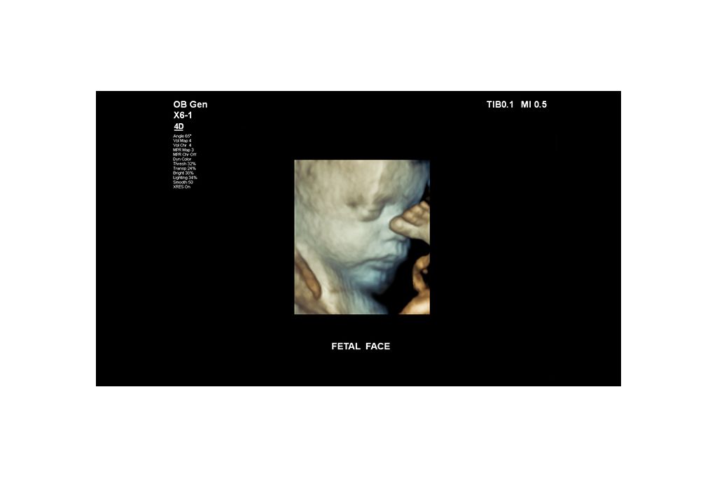 Fetal face