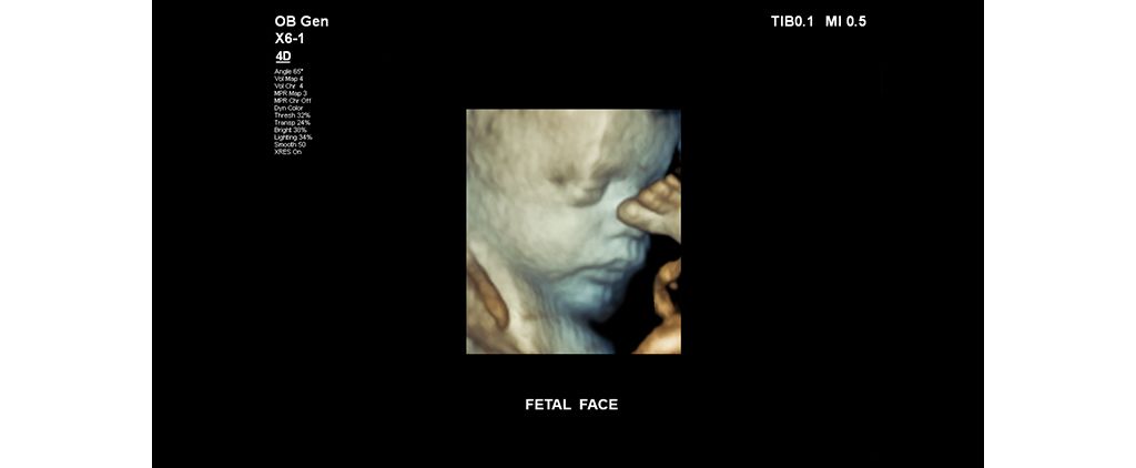 Fetal face