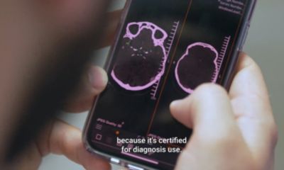 Stroke viewer