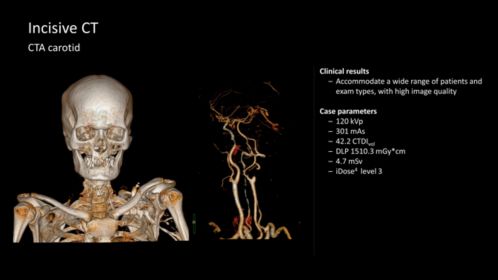 Incisive Ct Ct Scanner Philips Healthcare