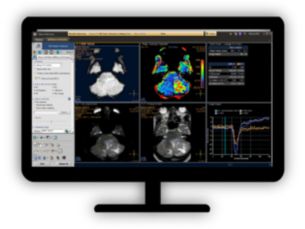 MR T2* Neuro Perfusion​ Reviewing brain tissue perfusion viability