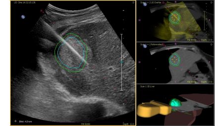 Utilize fusion across different clinical disciplines