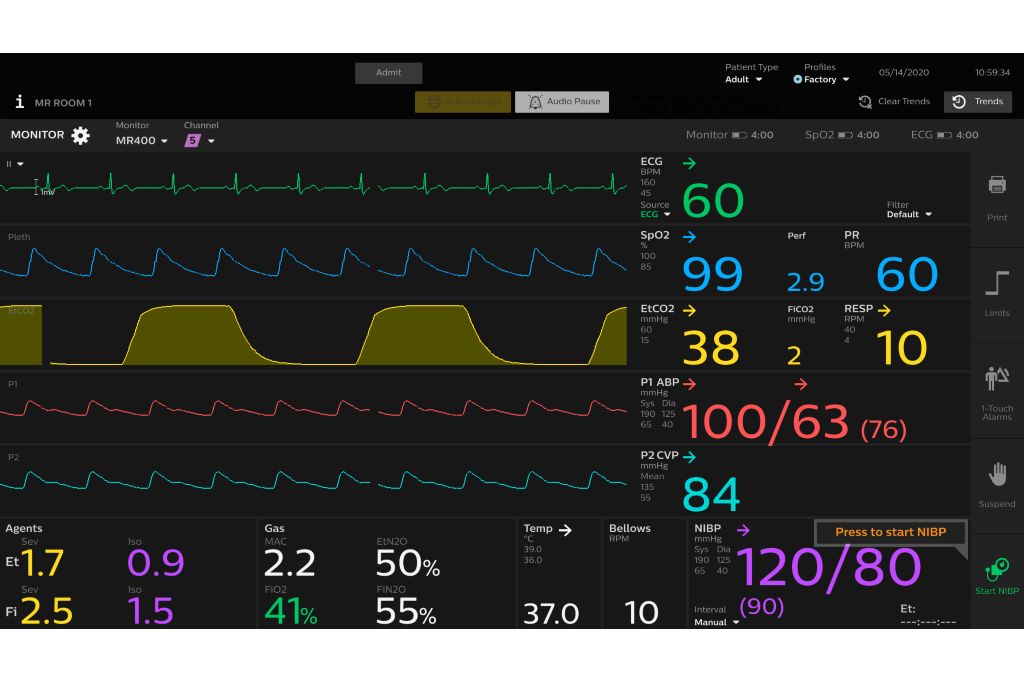 Portal 5000 Vital Signs NIBP Start