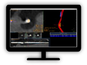 CT Cardiac Plaque Assessment ​Evaluate coronary plaque