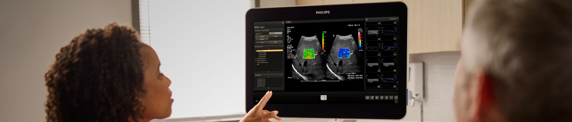 Sonographer showing ElastQ liver stiffness measurement on ultrasound screen to patient