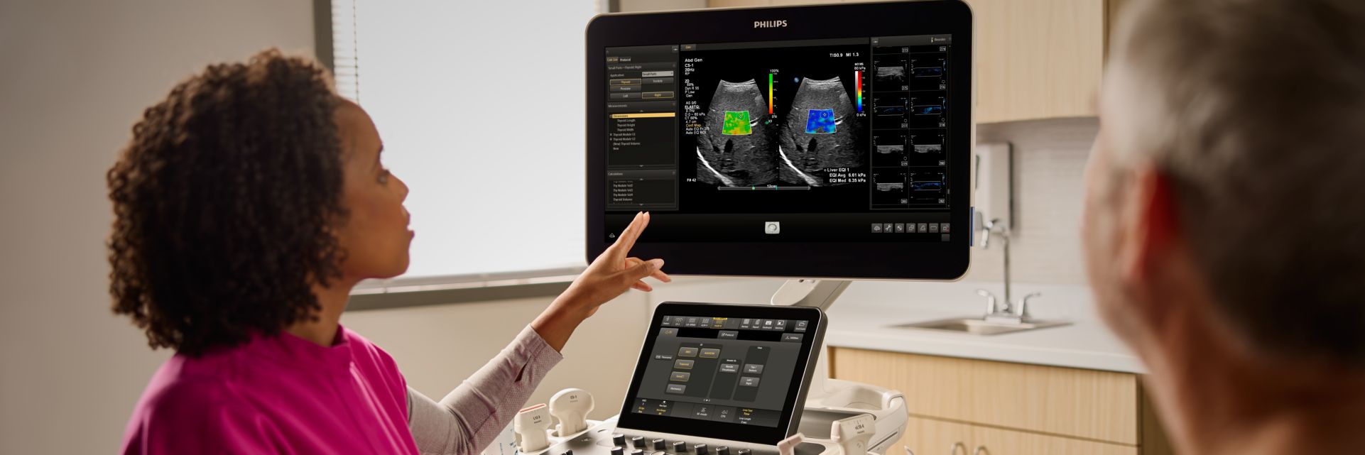 Auto ElastQ ultrasound elastography