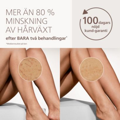 Philips Lumea IPL 9000
