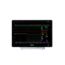 IntelliVue AD75 Active Display