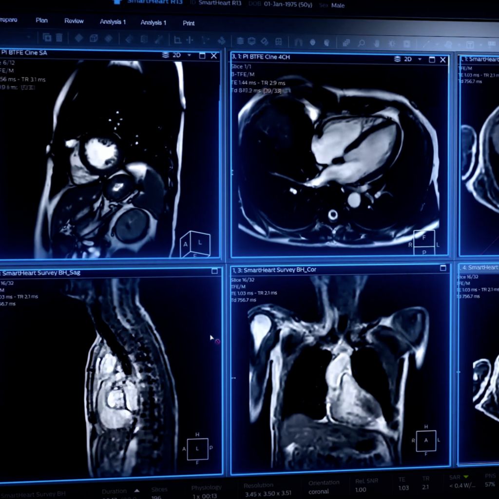 Cardiac MRI