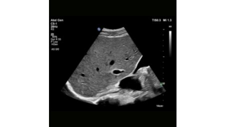 Next Gen Auto Scan