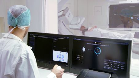 Get step-by-step guidance to simplify CBCT acquisition​