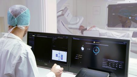 Step-by-step guidance to simplify CBCT acquisition