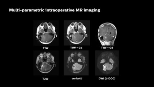 Multi-parametric intraoperative MR imaging
