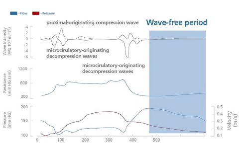 iFR wave free period image