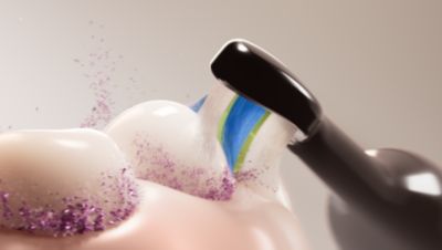Superior plaque removal and whiter teeth