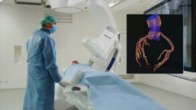 Clinician viewing synchronized CT coronary reconstruction during PCI procedure