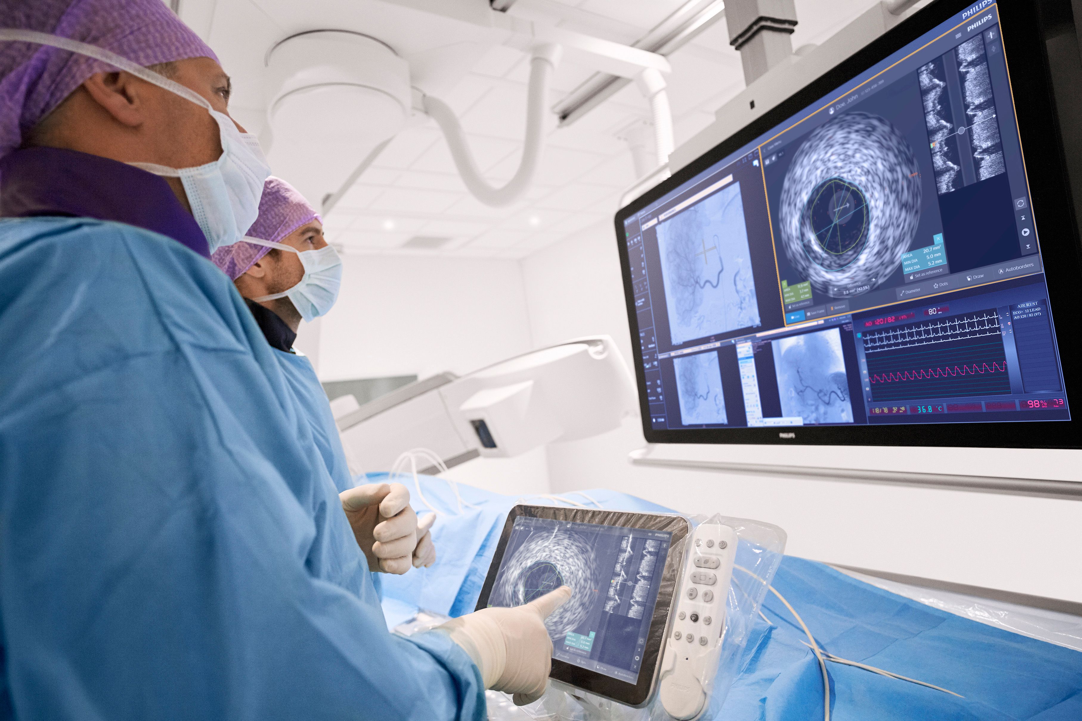 Sistema de imagen Philips IntraSight en uso