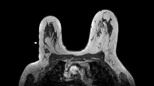 Axial dynamic 3D T1w FFE