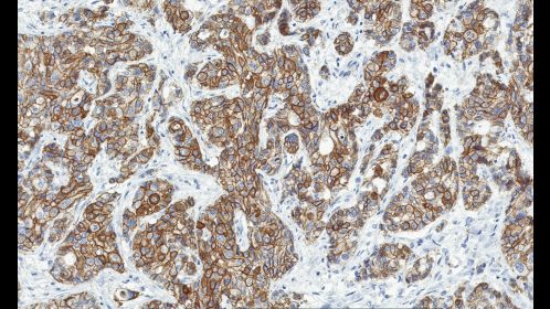 Clinical image digital pathology