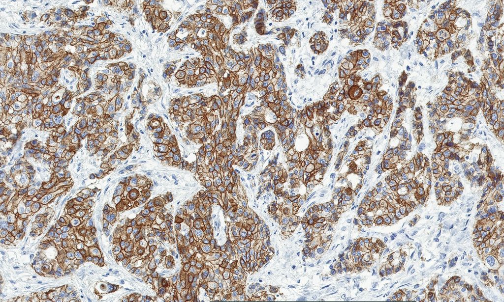 Clinical image digital pathology