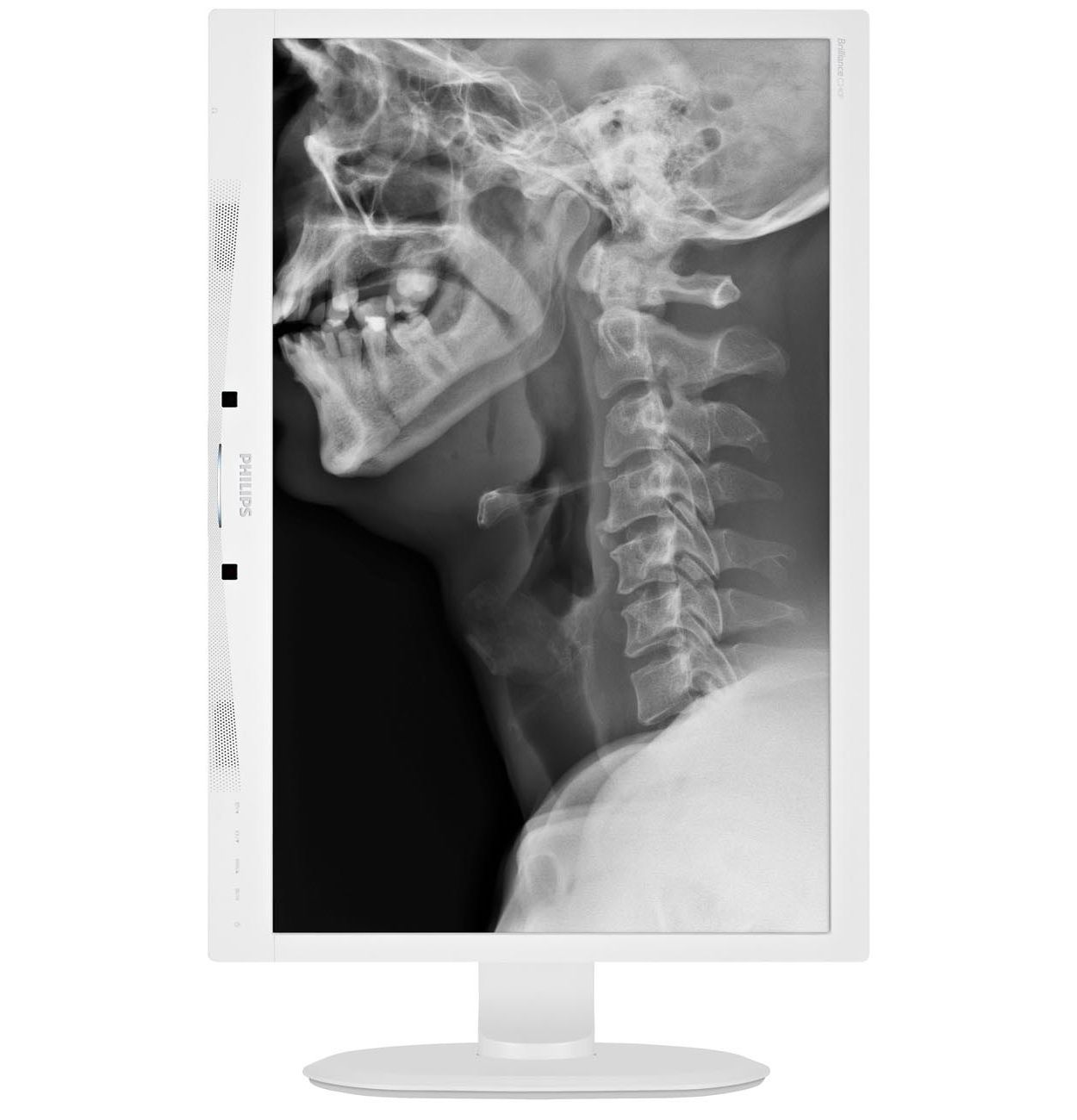 液晶モニター PHILIPS 24インチ WUXGA(1920×1200) IPS C240P4QPYEW/11 ホワイトベゼル モニター】Philips 『C240P4QPYEW/11』 画像など | ヲチモノ
