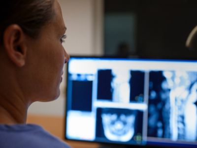 Médico revisando imágenes médicas en un monitor de computadora