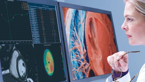 IntelliSpace Portal 12 All your advanced analysis needs, one comprehensive solution​​