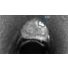 DynaCAD Prostate calculated high b-value thumbnail